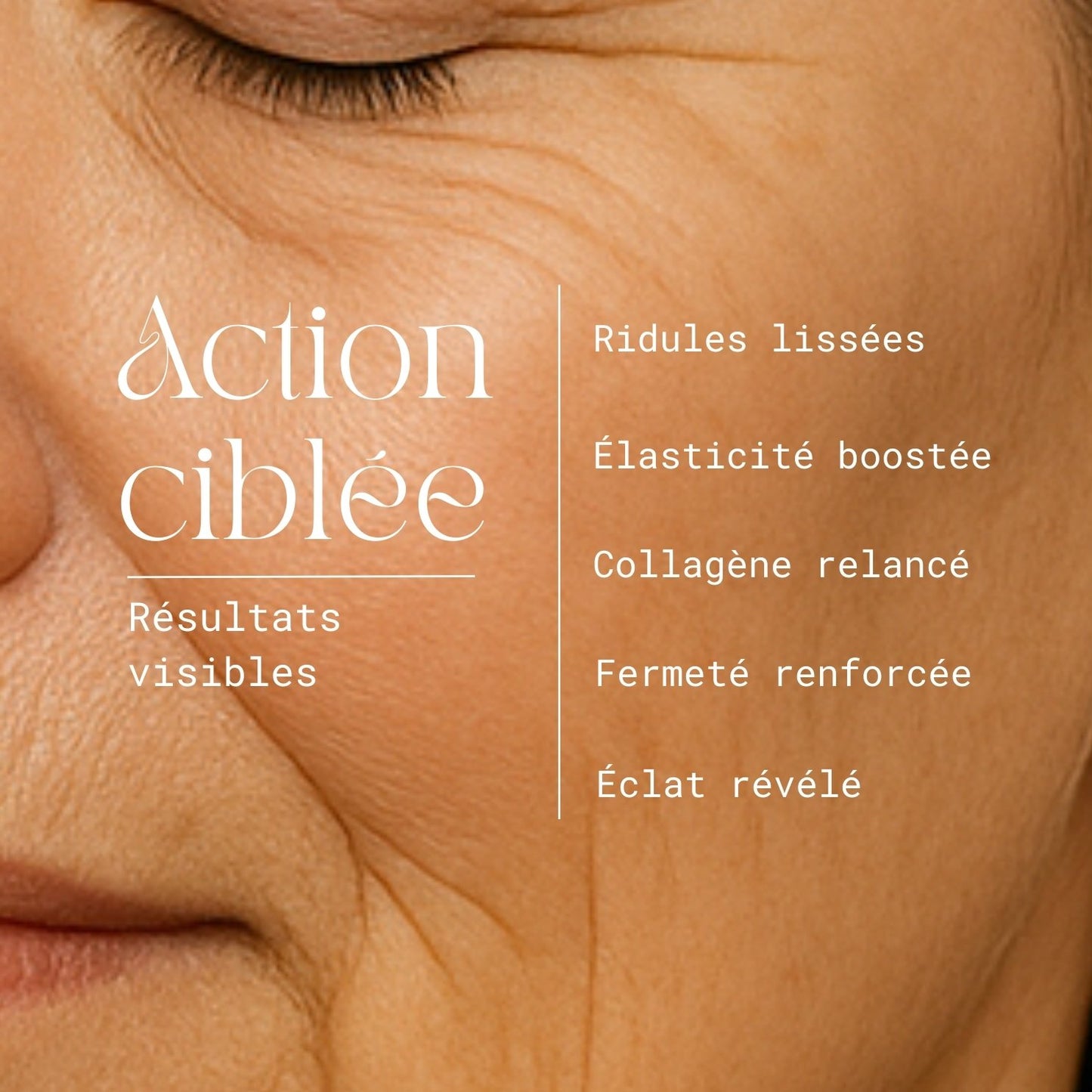 La cure de collagène