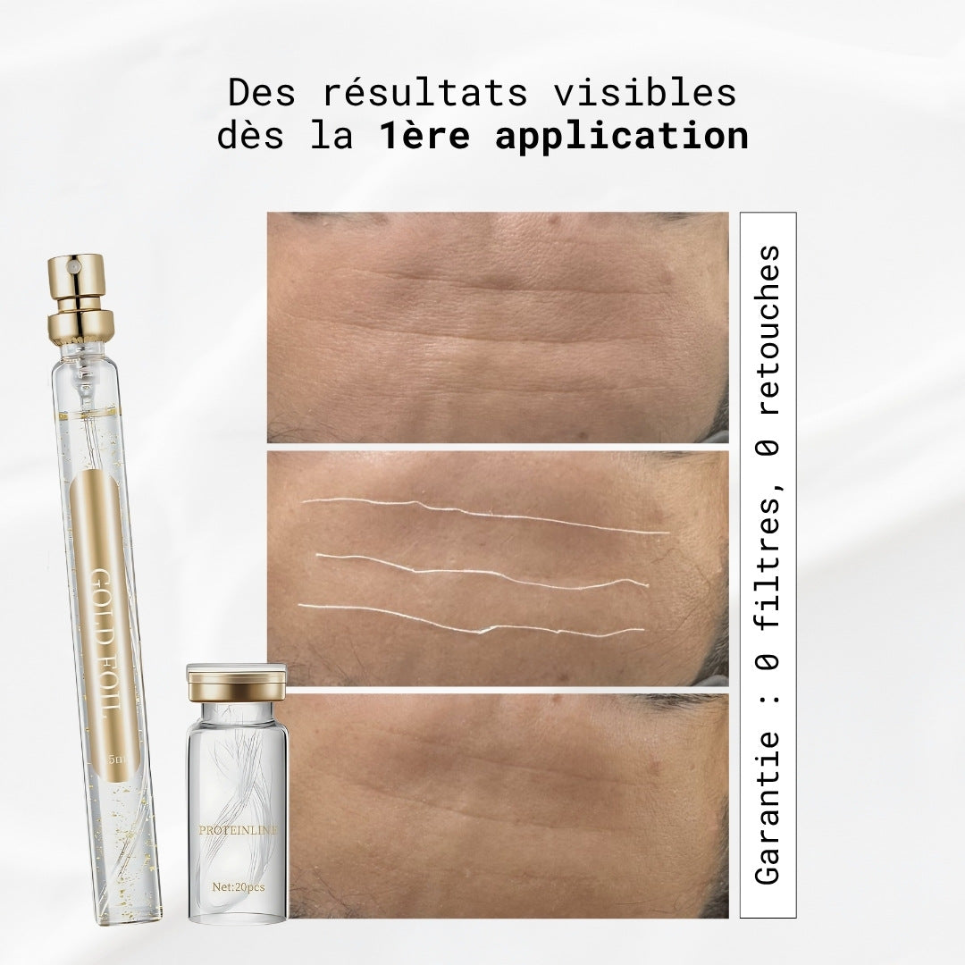 Fils tenseurs de collagène